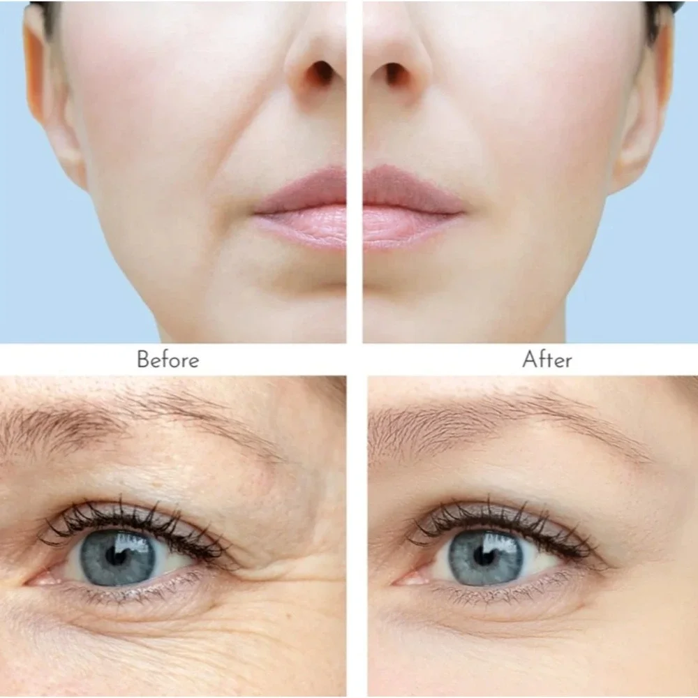 Truly Beauty Clear Wrinkle Patches – 4‎ Pack